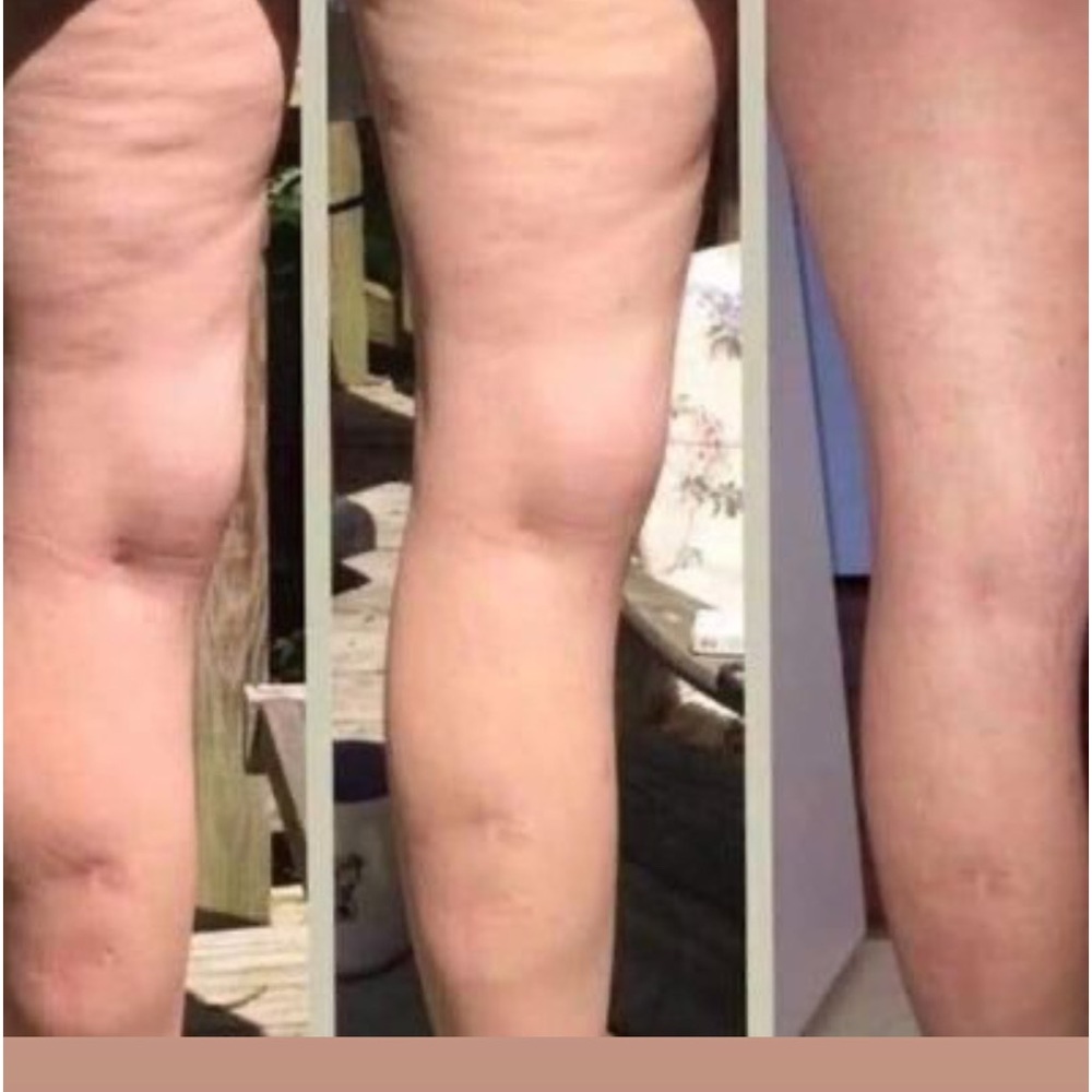 Nu Skin Dermatic Effects cellulite firming cream - Picture 7 of 16